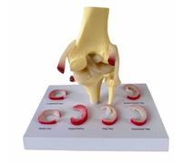 Knee Joint Model - Anatomical Flesh Representation for Meniscus Injury and Ligament Repair - 20cm for Medical Education and Training
