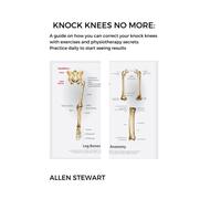 Knock Knees No More: A guide on how you can correct your knock knees with exercises and physiotherapy secrets: practice daily to start seeing results: Allen Stewart