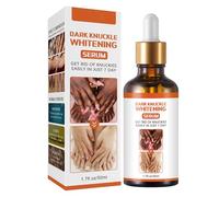 KOAHDE Knuckle Skin Lightening Serums,Dark Knuckle Corrector Serums,Dark Knuckle Whitening Serum,Hand Knuckle Whitening Serums,Dark Knuckle Whitening Cream,Acanthosis Nigricans Therapy Oil,1PC