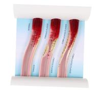 KOMBIUDA Dynamic Human Vascular Model Medical Teaching Blood Vessel Simulation Lightweight Anatomy Model for Medical Students and Professionals