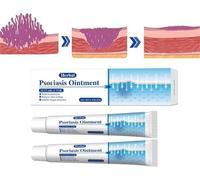 KoTinea Soothing Ointment, KoTinea Psoriasis Cream, Psoriasis Ointment Extra Strength, Psoriasis Treatment, for All Skin (2Pcs)