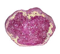 KYEYGWO Titanium Coated Natural Crystal Raw Geode Stone, Quartz Cluster Specimen Gemstone Decor Irregular Natural Piece Stones Ornament for Healing Collection, Fushcia
