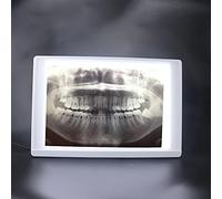 Lab Equipment X-Ray Film Illuminator Light Box X-ray Viewer Light Panel Screen