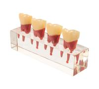 LABRIMP Teaching Model Resin Oral Anatomy Educational Aid for Deciduous Teeth with Interactive Removable Teeth for Classroom Use and Consultation Practice