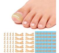LANEPORD Ingrown Toenail Treatment Patches | 110Pcs Professional Corrector Strips & Stickers for Pain Relief and Nail Growth Angle Correction | Breathable