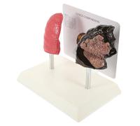 LAPYAPPE Vivid Smoking Lung and Lung Comparison Model Medical Respiratory Teaching Tool with Realistic Anatomical Details and Use for Students and Health Education