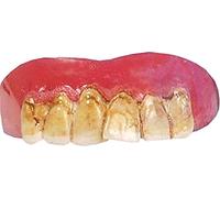 Leaning Yellow Austin Powers Nerd Teeth with Topping Costume Accessory Fake Bit Nerd