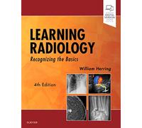 Learning Radiology: Recognizing the Basics