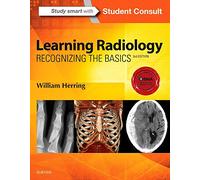Learning Radiology: Recognizing the Basics