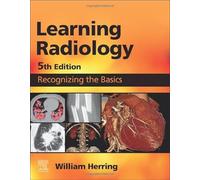 Learning Radiology : Recognizing the Basics