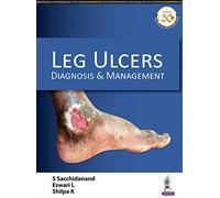 Leg Ulcers: Diagnosis & Management