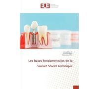 Les bases fondamentales de la Socket Shield Technique