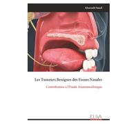 Les Tumeurs Benignes des Fosses Nasales: Contribution à l'Étude Anatomoclinique