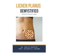 Lichen Planus Demystified Doctors Secret Guide