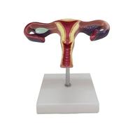 Life-Size Female Uterus Model, Human Reproductive System Anatomy Model with Ovary for Medical Health Education organ model