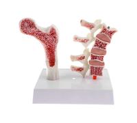 Life-Size Human Bone Anatomy Model - Lumbar Vertebrae & Femur Osteoporosis Skeletal Pathology Teaching Tool