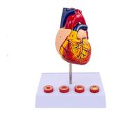 Life Size Human Heart Model with 4 Stages of Thrombosis for Teaching Aid丨1:1 4D Natural Larged Scientific Heart Model with 34 Digital Signs and Sturdy Base for Classroom Teaching Explanation