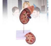 Life-Size Kidney Anatomy Model, Human Kidney Dissection Model, Divided into 2 Parts for Teaching, Doctors Office, Educational Tool