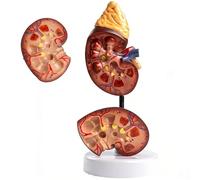 Life-Size Kidney Anatomy Model with Digital Sign, Realistic Detachable Human Kidney Anatomy Demonstration Model for Physiology and Biology