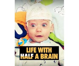 Life with Half a Brain