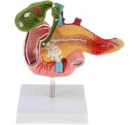 Lifesize Human Pancreas Duodenum Gallbladder Model with Vessels & Nerves, School Teaching Aid