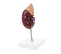 LIGIGWASH Human Kidney Dissection Model with Adrenal Gland Biological Anatomy Demonstration Tool for Medical School Teaching Display with Base and Bracket