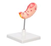 LIGIGWASH Human Stomach Teaching Aid for Medical Schools and Realistic Anatomy Tool for Anatomy Education and Clinical Understanding