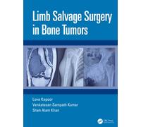 Limb Salvage Surgery in Bone Tumors