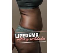 LIPEDEMA: Mitos y Realidades