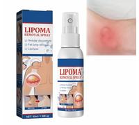 Lipoma Removal Spray,Lipoma Reduction,Anti-cellulite Body Shaper Spray for Men and Women, 50ml