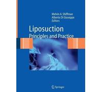 Liposuction - 9783642066320