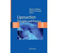 Liposuction by Shiffman, A. New 9783642066320 Fast Free Shipping<-