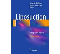 Liposuction: Principles and Practice