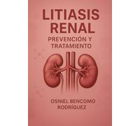 LITIASIS RENAL. PREVENCION Y TRATAMIENTO