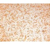 Live Copepods for Fish, 20 x 100ml Packs, Fresh Tropical/Marine Fish Feed Fry