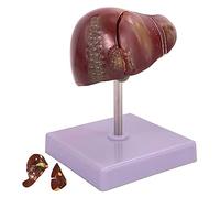 Liver Model Educational Tool, Life-Size Human Anatomy Replica with 2 Detachable Parts for Teaching and Demonstration of Pathology