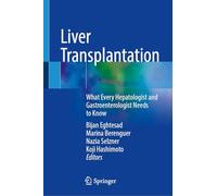 Liver Transplantation: What Every Hepatologist and Gastroenterologist Needs to Know