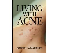Living With Acne: A Clear, Medical Guide to Understanding, Treating, and Living Confidently with Acne