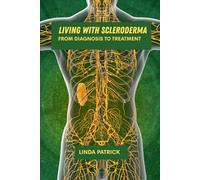 Living with scleroderma: From diagnosis to treatment