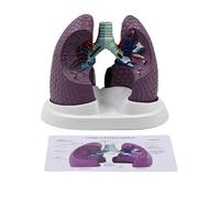 Ljmyy Anatomical Pathological Lung Model Normal and Pathological Lung Anatomy Model for Teaching Research Clinical Settings