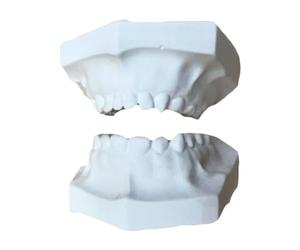 LKYLVEE 24pcs Milk Teeth Super Hard Plaster Model Dental Plaster Casts Model Full Mouth Standard Maxillofacial Dental Model for Children,B,life size
