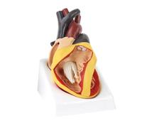 LKYLVEE Cardiac Malformation Teaching Model - Complete Atrioventricular Canal Malformation Heart Model - for Classroom and Cardiology Study,Flesh,17cm