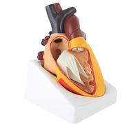 LKYLVEE Complete Aortic Transposition Heart Model - Anatomical Congenital Heart Disease Model - for Science Classroom And Cardiology Study,Flesh,17cm