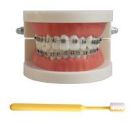 LKYLVEE Dental Orthodontic Demonstration Model Standard Teeth Treatment Model with Metal Bracket,Arch Wire Explaining Model with Braces, with Toothbrush