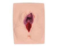 LKYLVEE Female Vulva Incision Perineal Suture Practice Model,Vulva Suturing Training Simulator,Simulator Practice for Gynecology Teaching Medical Student, Doctor Training