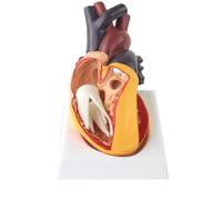 LKYLVEE Human Ventricular Septal Defect Heart Disease Model - Congenital Heart Disease Model - for Medical Patient Doctor Teaching,Flesh,17cm
