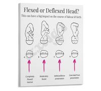 LLBOGRGGN OB Nursing Reference Poster Fetal Head Position Guide Through the Pelvis Canvas Print for Maternity Ward(Framed,08x12inch(20x30cm))
