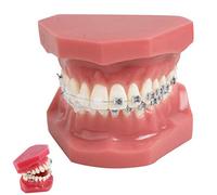 LMEIL Dental Teeth Orthodontic Model with Metal and Ceramic Brackets Oral Demonstrating Models for Dentist To Communicate with Patients