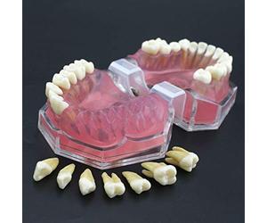 LMEIL Teeth Model Soft Gums Full Disassembly Learning Exercises Tooth Extraction Full Mouth Disassembly Tooth Model for Dental Teaching or Dentist To Communicate with Patients