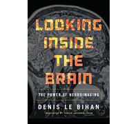 Looking Inside the Brain: The Power of Neuroimaging